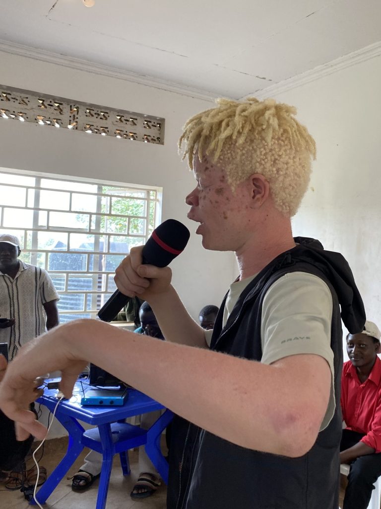 A young man with albinism sings into a mic in front of a few seated listeners.